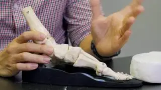 How to tell if your foot orthotics are truly custom-made