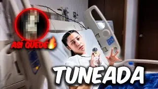 Me TUNEE y AS&Iacute; ME FUE|| VLOG DE MI OPERACI&Oacute;N EST&Eacute;TICA 🩸💉😱
