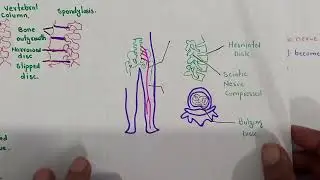 Disorders of the Skeletal System | Class 11 Biology | PTB 2025 | Osteoporosis, Arthritis  Explained