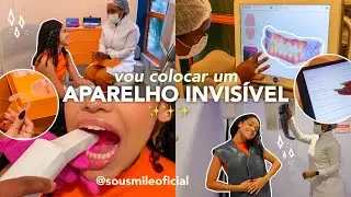 vou colocar aparelho INVISÍVEL✨| sousmile, skan 3D…