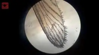 Mosquito wings under microscope