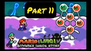 Mario & Luigi Bowser's Inside Story: Part 11