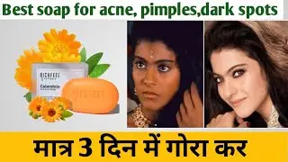 Richfeel calendula anti acne साबुन जो दे गोरी त्वचा | Review of Richfeel calendula soap