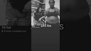 Weight loss transformation #VSG
