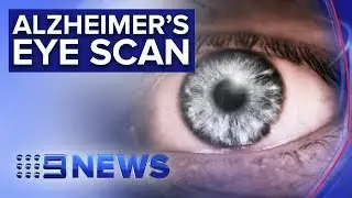 World-first trial of Australian research being fast tracked | Nine News Australia