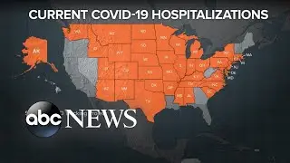 COVID-19 cases surge with more than 82,000 in single day