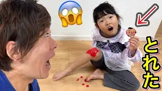 かさぶた取れたよ&hellip;気になったここちゃんが取ってしまいました・・・・・😱【実話再現】