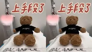 上手段了🤷BBL HERO+翻土联合重建🧖 #沉浸式护肤 #上手段了 #偷懒方法 #变漂亮  #创作灵感