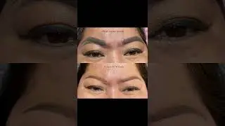 Eyebrow tattoo removal #lasertattooremoval #eyebrowtips #ombrehair #microblading #tattooremoval