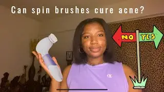Can spin brushes cure acne? Hyperpigmentation + Product Review
