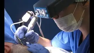 Cuidados posteriores al trasplante de pelo FUE | Cl&iacute;nica Dermitek Bilbao