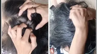 Cari kutu nya gantian belgiliran biar seru 💪🏻💪🏻💪🏻
