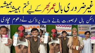 Permanent Hair Facial Treatement | Best Skin Whitening Products |