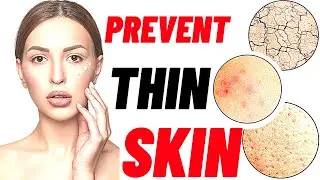 How to prevent and treat thinning skin [18 tips]