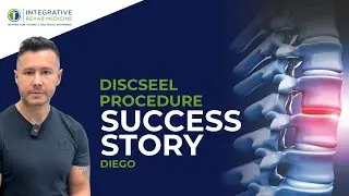 Is Shoulder Arthritis Making You Stiff? Watch This!