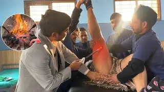 3th grade AVN & Knee Joint Pain Treatment 🔥 Ayurved Agnikarma Asli Ilaaj | Dr amit Prasad 