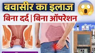 Laser Piles Treatment at Rana Hospital | Painless Hemorrhoids Surgery Explained