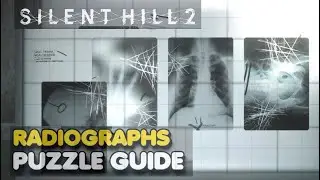 Silent Hill 2 X-Ray Puzzle Solution | Brookhaven Hospital