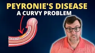 Peyronies Disease A curvy problem | How to FIX a CURVED penis: Dr Kent DeLay