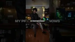 My Prosthetic Leg has an App?? Here&rsquo;s how it works