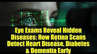 Eye Exams Reveal Hidden Diseases: How Retina Scans Detect Heart Disease, Diabetes & Dementia Early