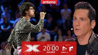 🔥 Ștefan Munteanu și „Creep” – un moment de neuitat în Finala X Factor România! 🎤
