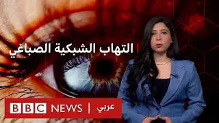 ماذا نعرف عن العشى الليلي؟