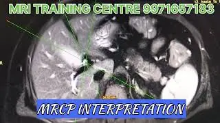 MRCP PLANNING INTERPRETATION, SEQUENCE, ANATOMY, PATHOLOGY