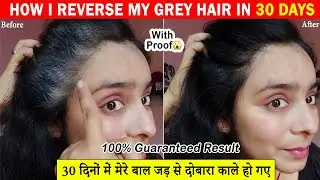 मेरे सफ़ेद बाल जड़ से काले हुए सिर्फ 30 दिनों में😱 My Grey Hair Reversal Success Story | 100% Results