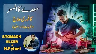 MAIDAY K ULCER KA ILAJ | Stomach ulcer and H.Pylori treatment | life style changes