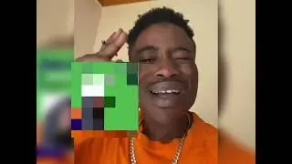 Amaziga😭 Ku Kkooti Nga Alien Skin Bamuleese.