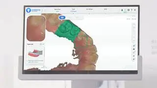 Aoralscan 3 - Scan Procedure