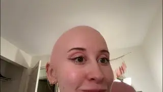 GOING BALD