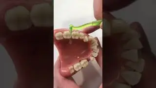 Using an Interdental Brush