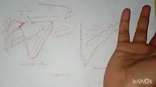 Anatomy MBBS first year Scapula bone fullexplained#notes#explanation#Scapula#anatomy#mbbs#first year