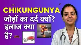Chikungunya Ke Baad Joint Pain Kyun Hota Hai? Causes, Treatment & Recovery