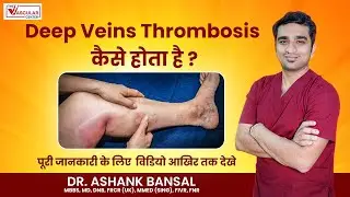 How Does Deep Vein Thrombosis Happen? | Causes of DVT | DVT Treatment Mumbai | Dr. Ashank Bansal