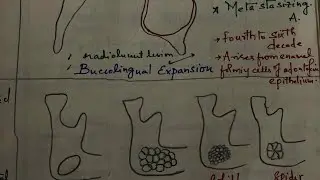 Radiolucent jaw lesions part 2