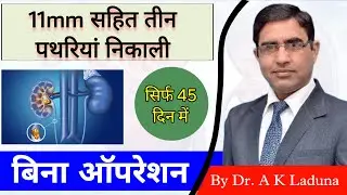 Painless Passage of 11 mm Kidney Stone | Clinical Evidence in Homeopathy