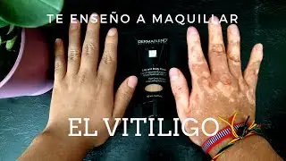 MAQUILLAJE PARA VITILIGO -TUTORIAL