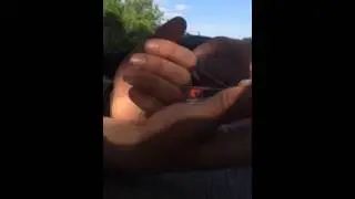 Fish hook removal from thumb