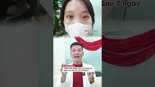 Đ&acirc;y c&oacute; phải l&agrave; một case m&iacute; bị lỗi? | B&aacute;c Sỹ H&ugrave;ng Thanh - Thẩm Mỹ GN