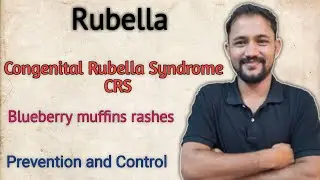 Rubella I Blueberry Muffin Rash I Congenital Rubella Syndrome I MR Vaccine I German Measles I PSM