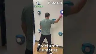 Shoulder Rehab For a Broken Humerus: Improving Function After a Fractured Arm | Physical Therapy