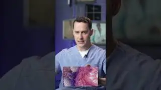 Химиотерапия хуже рака?! #рак #онкология #cancer #лечениерака #онко #здоровье