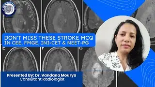 DON&rsquo;T MISS THESE STROKE MCQI ONLY 1% ANSWER IT CORRECTLY IN CEEI NEET PG IFMGE & INI CET EXAM