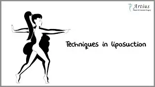Liposuction Latest Techniques | Newest Liposuction Techniques - Artius Clinic