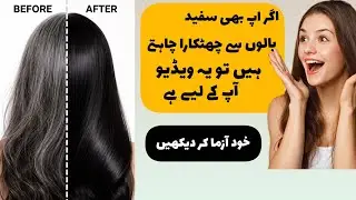 Natural Black Hair Dye at Home| Instant Grey Coverage| Treat Premature Greying
