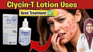 CLYCIN-T LOTION - Benefits, Side Effect, Uses & More in Urdu/Hindi | Acne treatment | How to Use