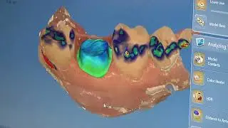 Dentists in Portage, MI - West Wind Dental